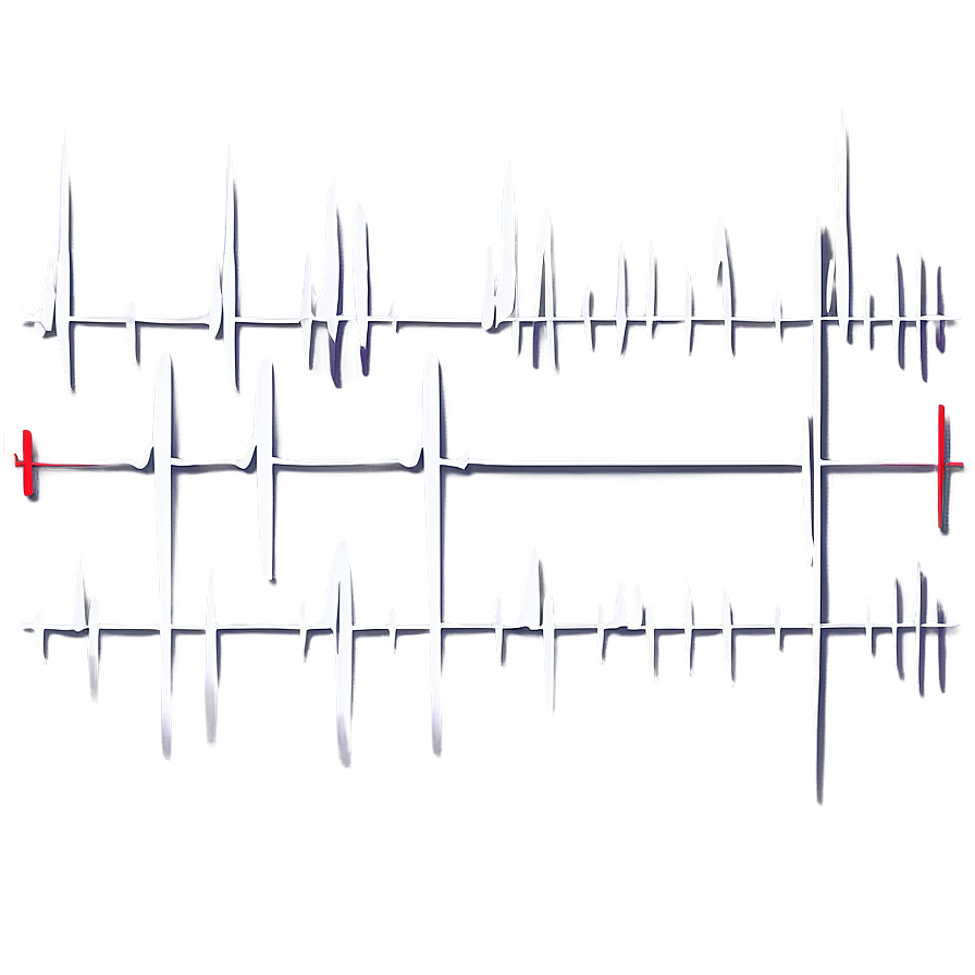 Cardiac Pulse Waveform Png 21