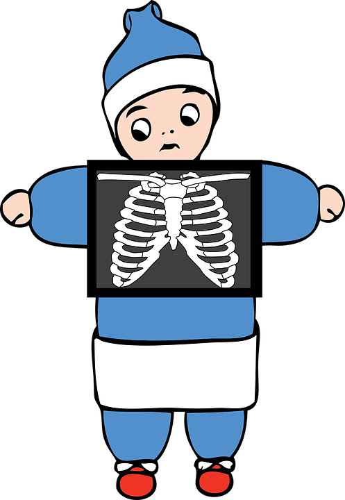 Cartoon Child Holding Xray