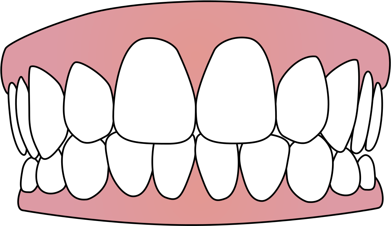 Cartoon Smile Teeth Illustration.png