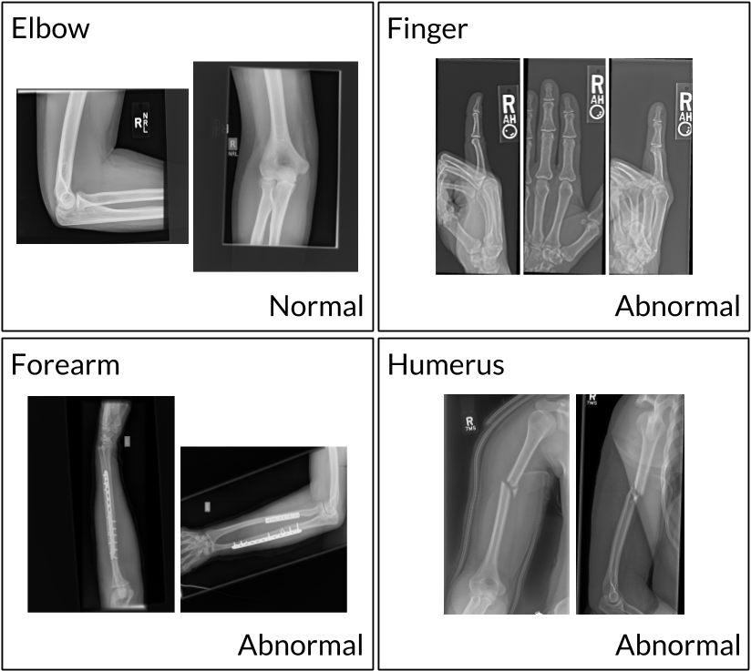 Comparative Xray Images Upper Limb