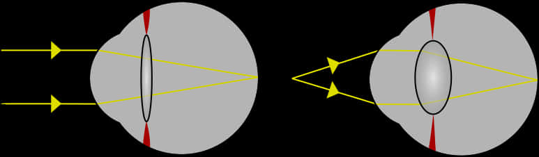 Concave_and_ Convex_ Lenses_ Light_ Refraction