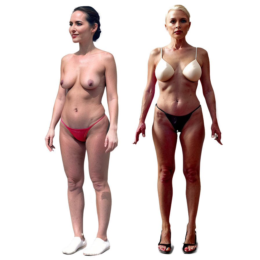 Cosmetic Surgery Before And After Png Htm