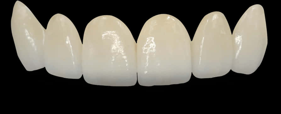 Dental Veneers Set