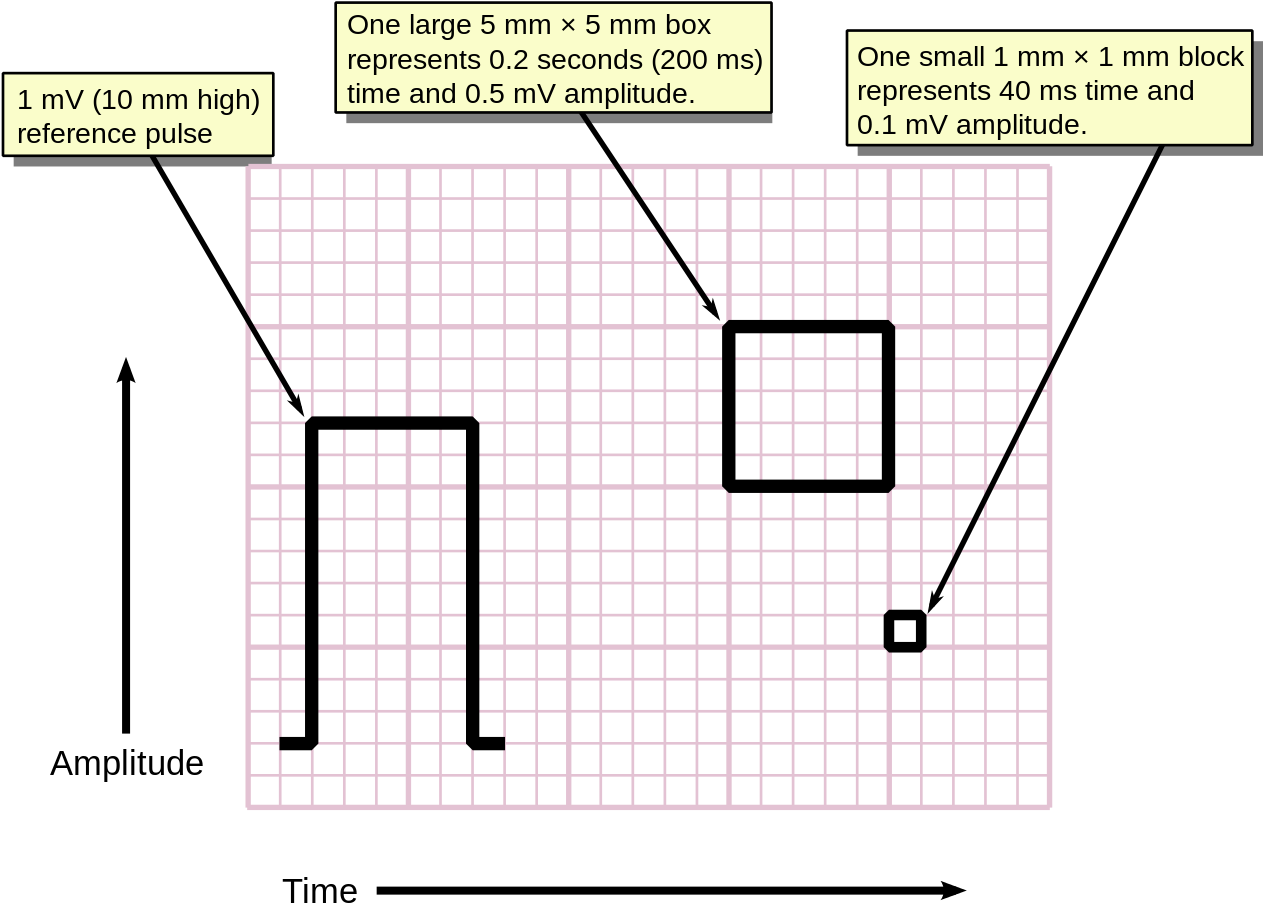 E C G Graph Paper Scale Explanation