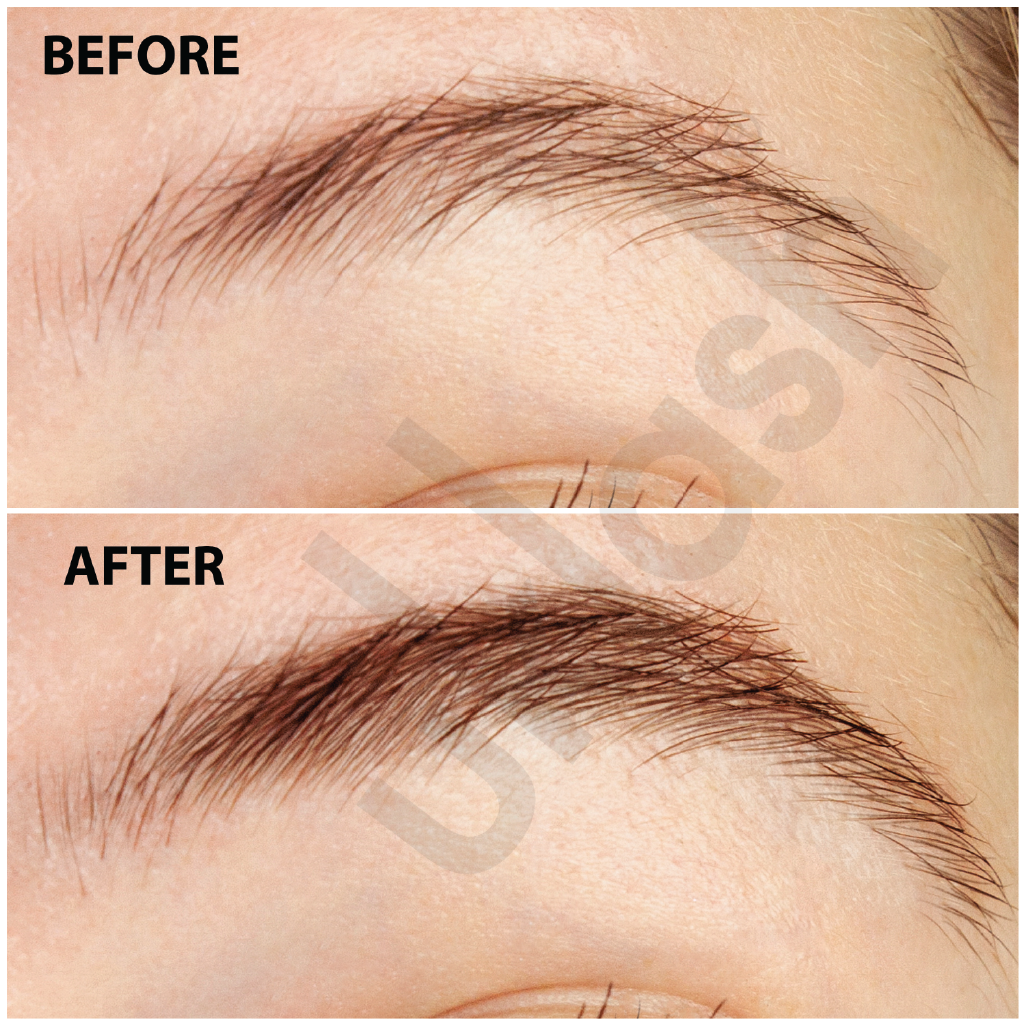 Eyebrow Transformation Before After