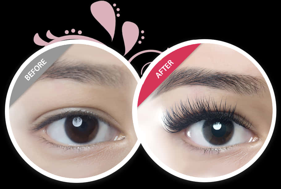 Eyelash Enhancement Comparison