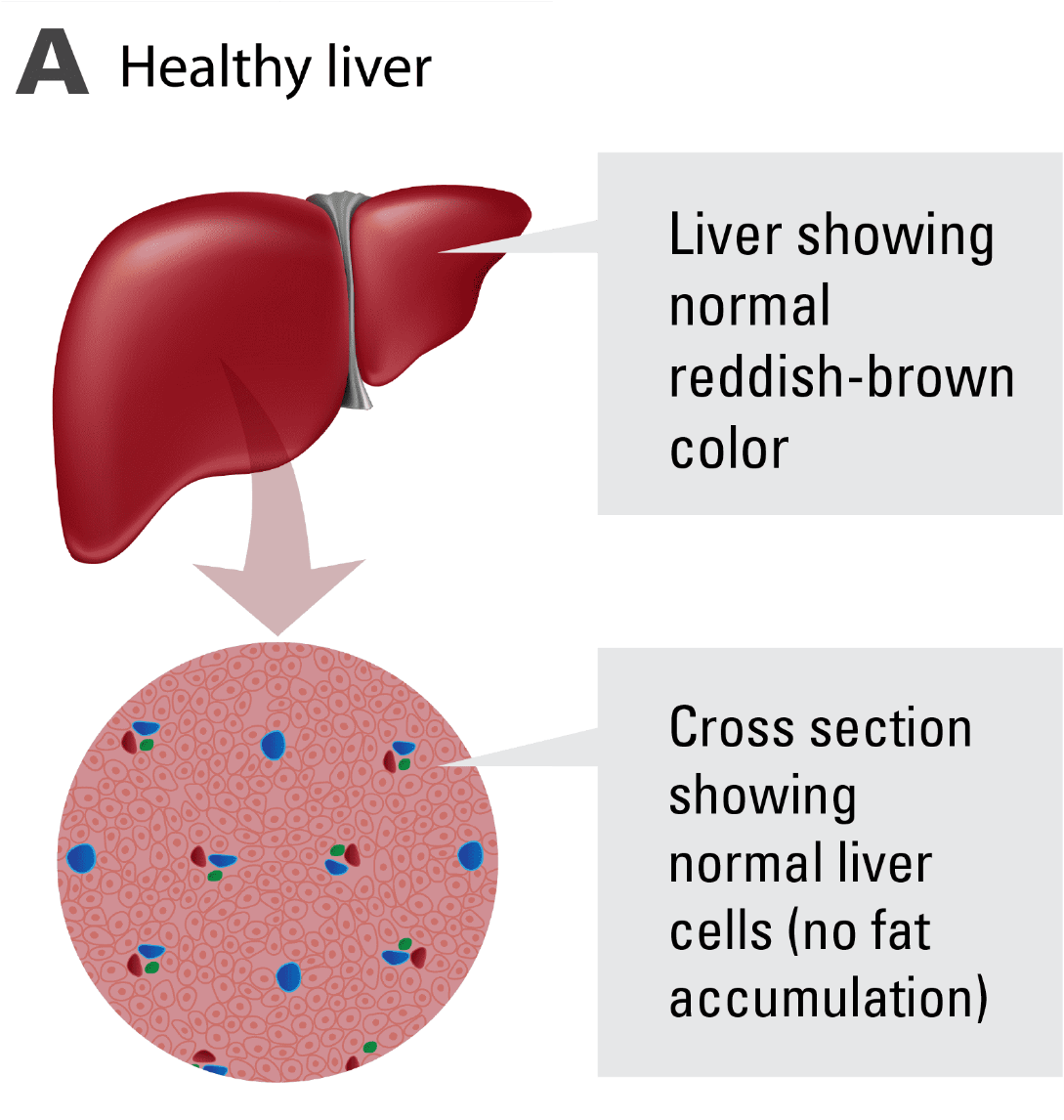 Healthy Liver Structureand Cells