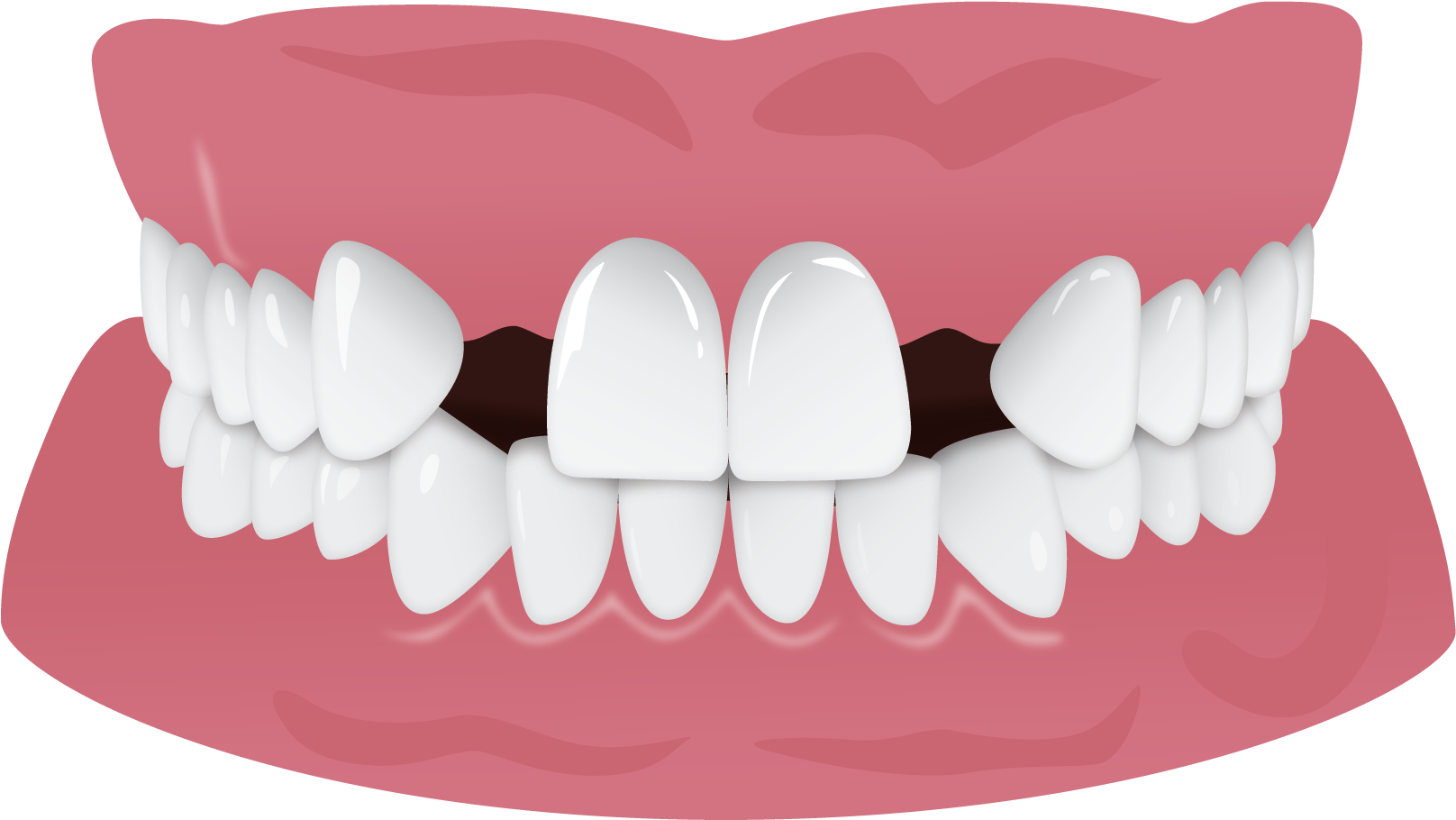 Healthy Teeth Illustration.png