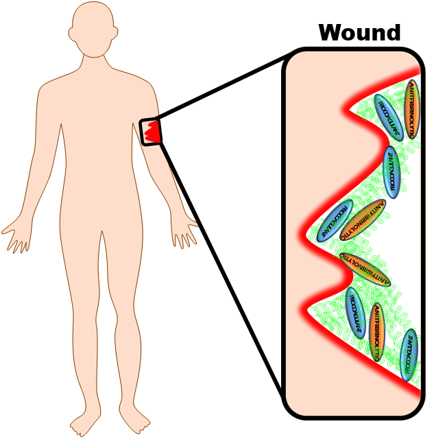 Human Anatomy Wound Diagram