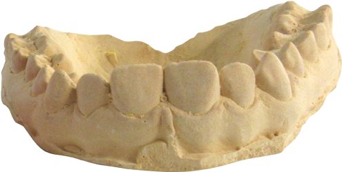 Human Lower Jawbone Model