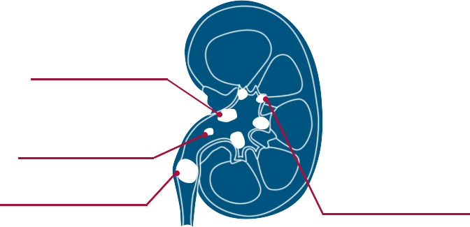 Kidney Anatomy Diagram