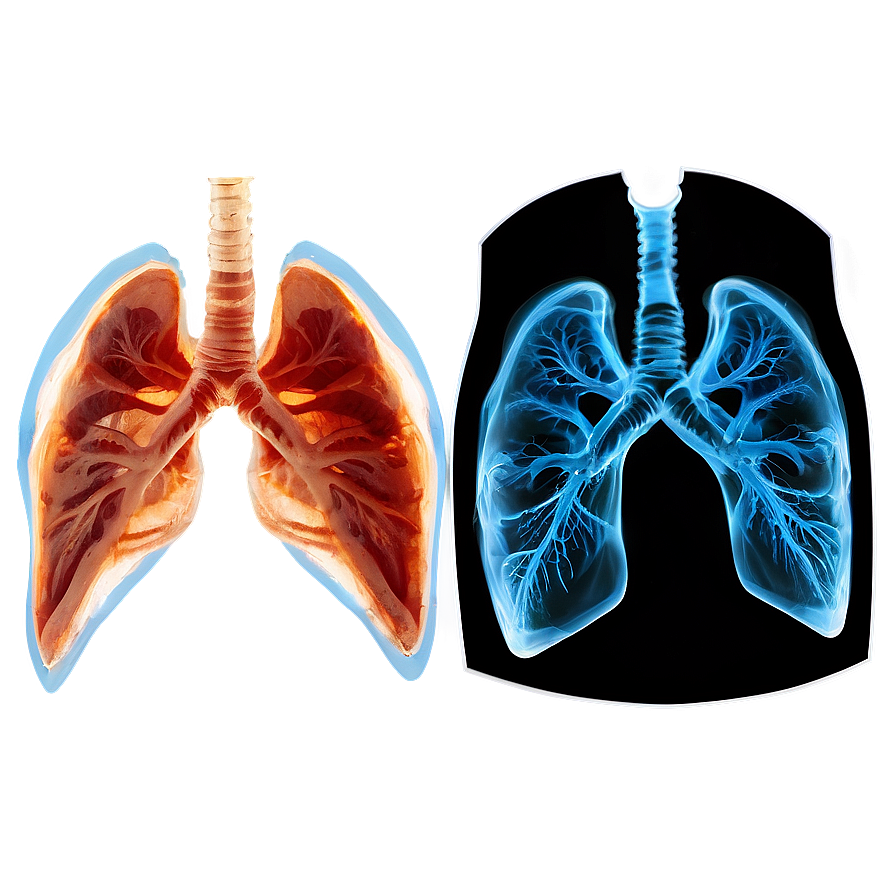 Lungs Under X-ray Png 05232024