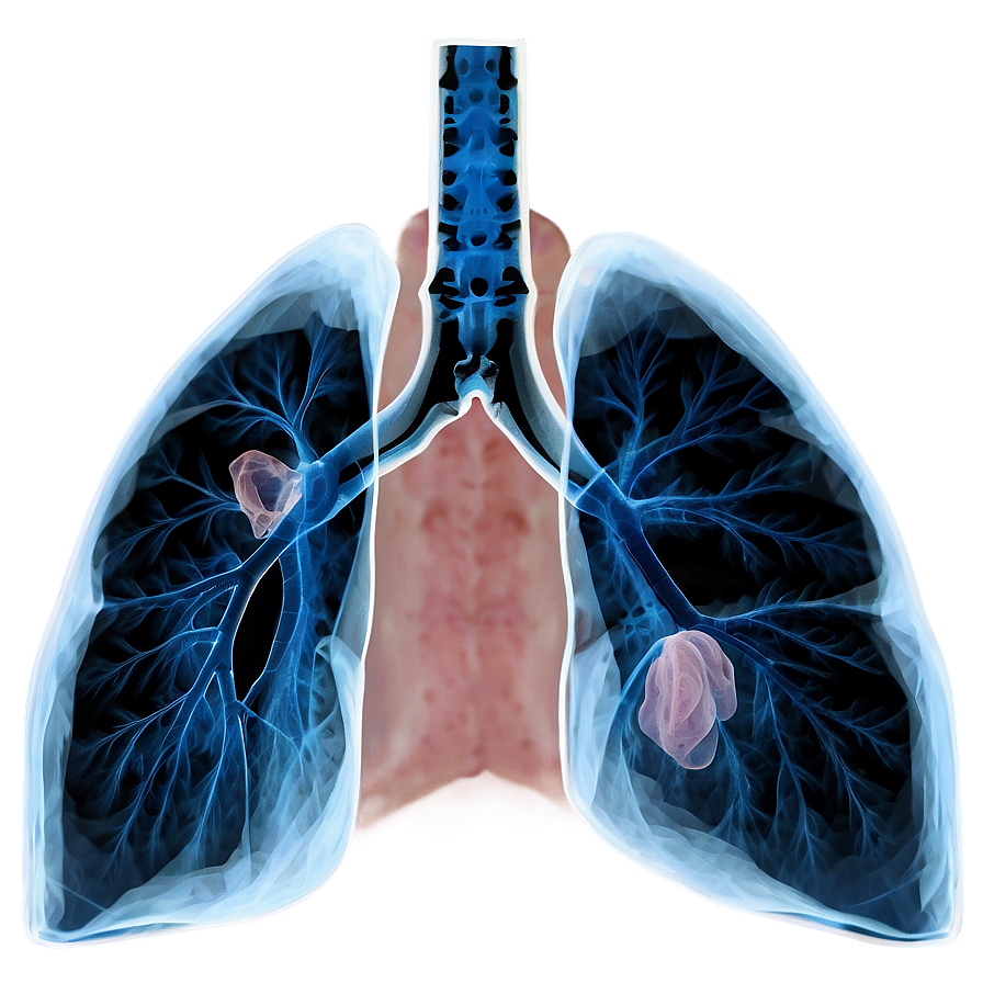 Lungs Under X-ray Png 05232024