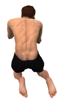 Man Kneeling Back Scars