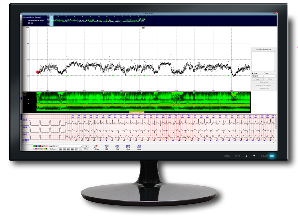 Medical Monitor Displaying Heart Rateand Sleep Data