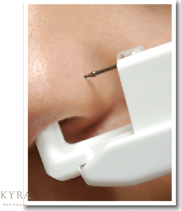 Nose Piercing Procedure Closeup