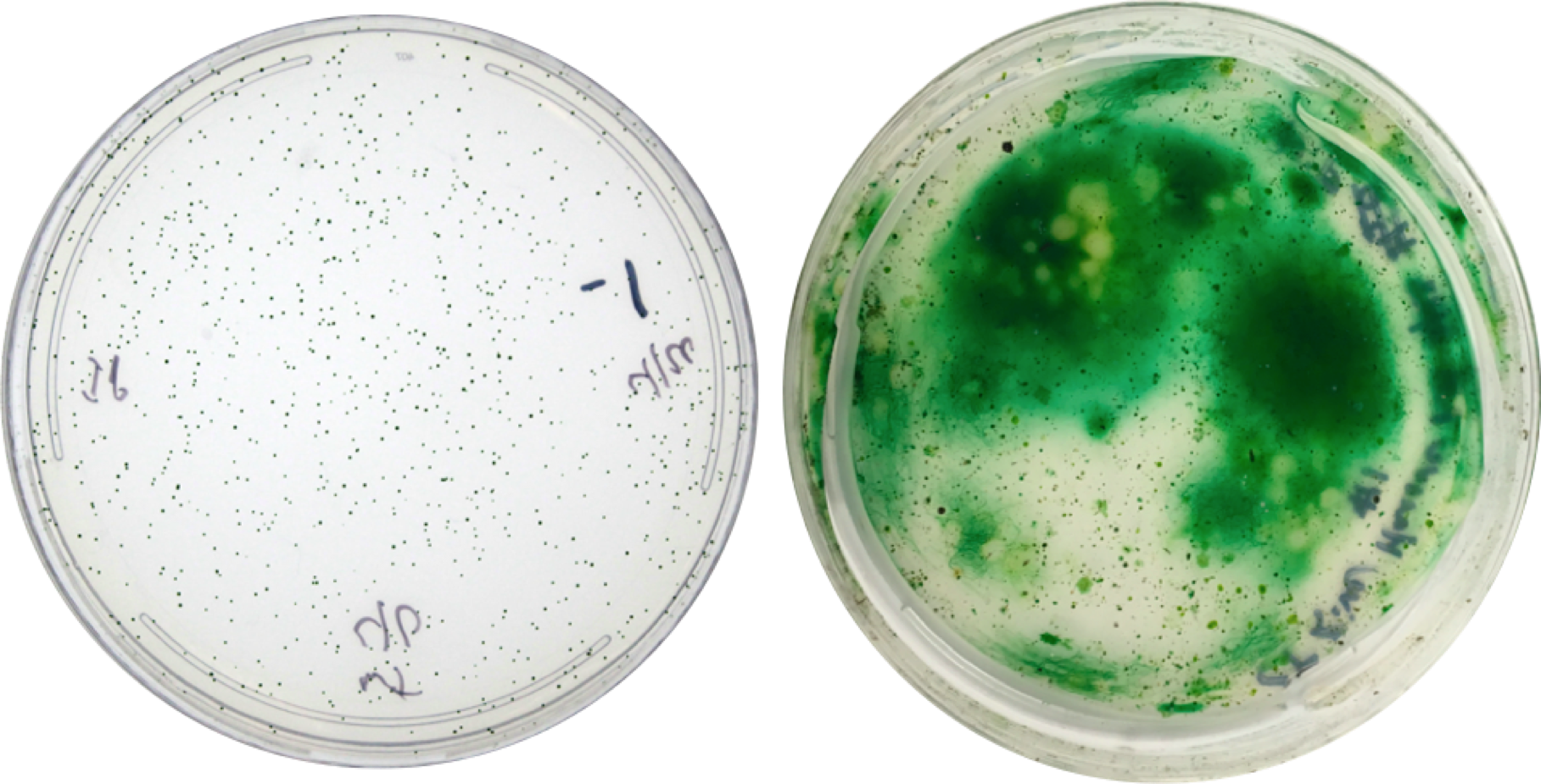 Petri Dish Bacterial Colonies Growth