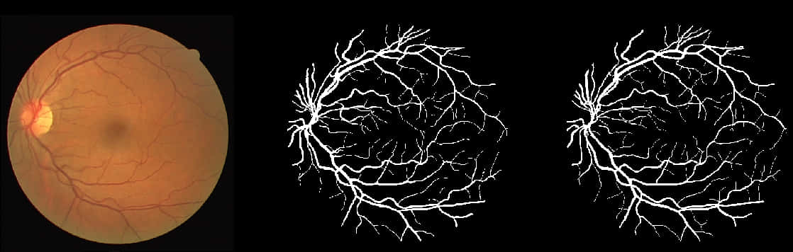 Retinal Imagingand Vascular Extraction