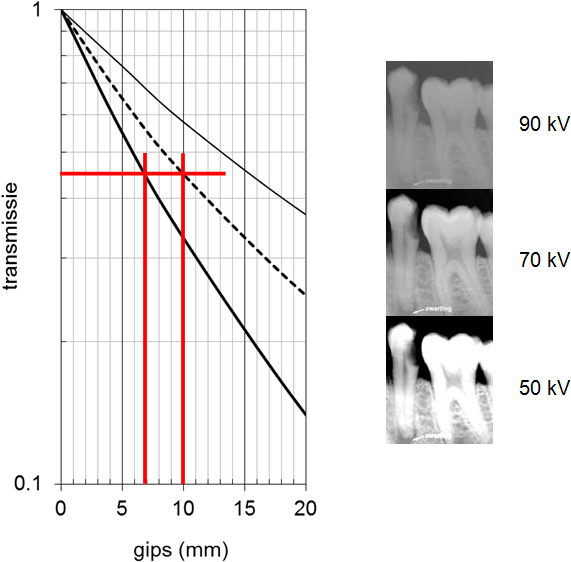 Xray Transmission Graphand Dental Imaging Comparison