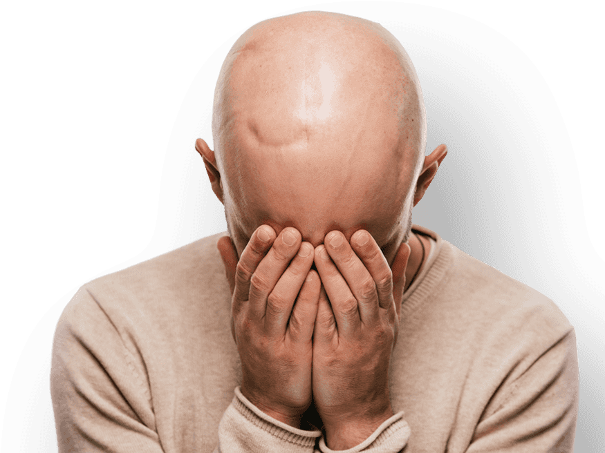 Bald Man Covering Face With Hands PNG image