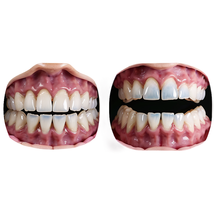 Before And After Dentures Png 83 PNG image