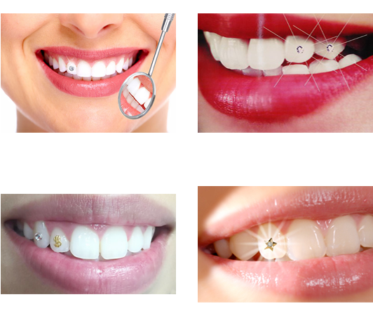 Dental Care Procedures Collage PNG image