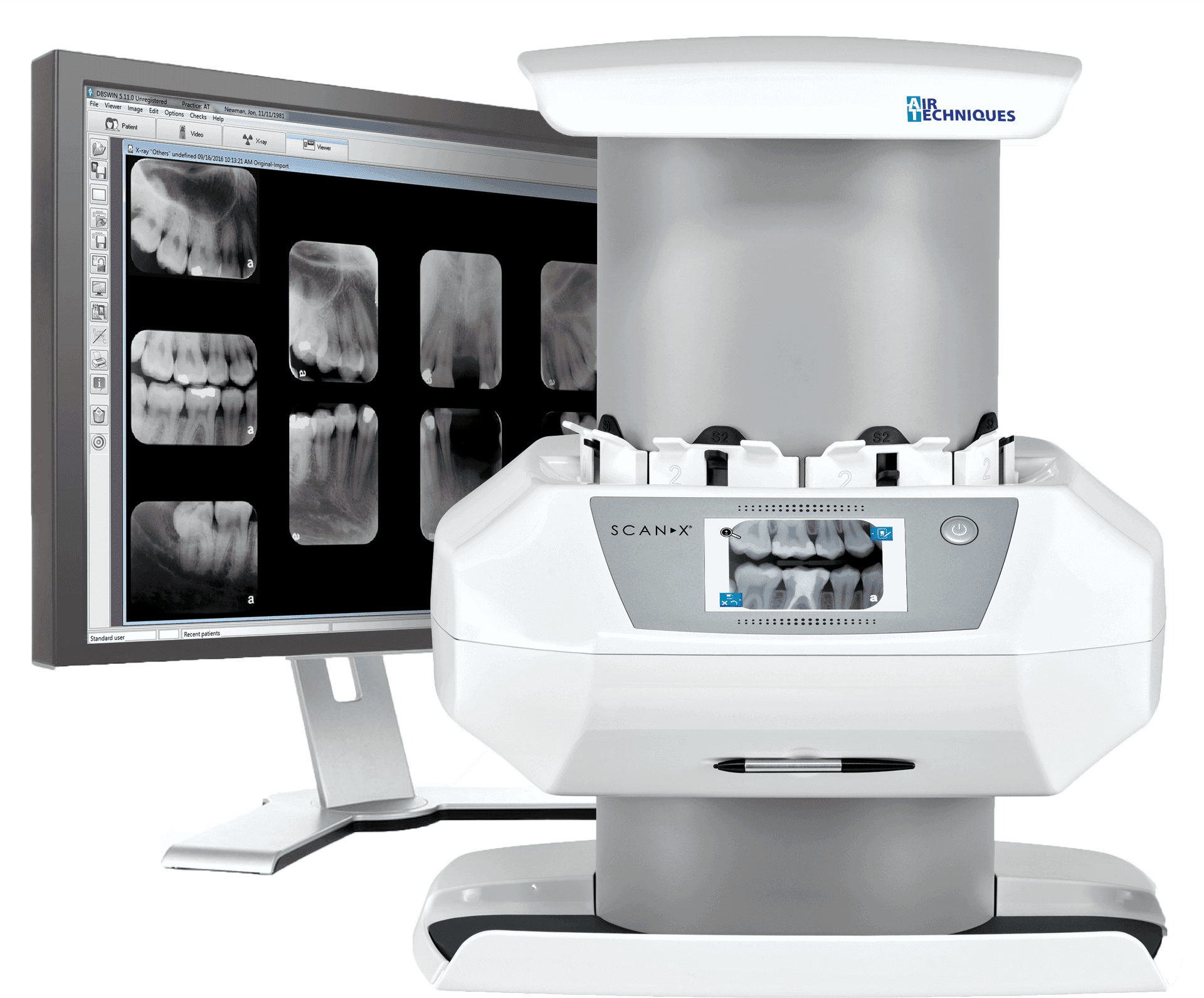 Dental Xray Scannerand Monitor Setup PNG image