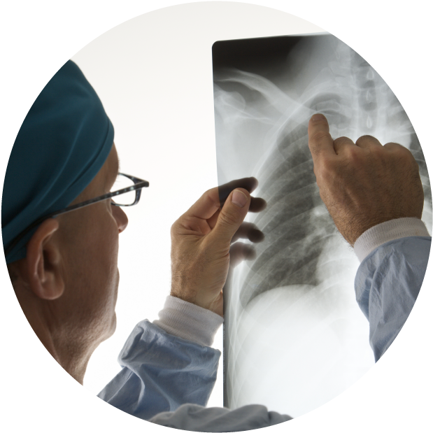 Doctor Examining Chest Xray PNG image