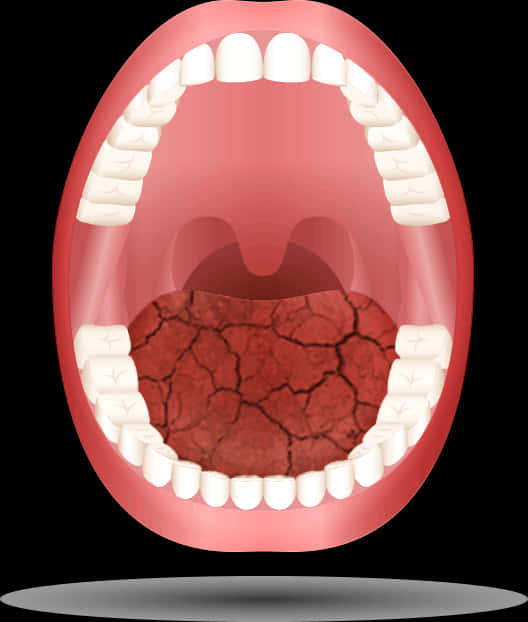 Dry Mouth Illustration PNG image