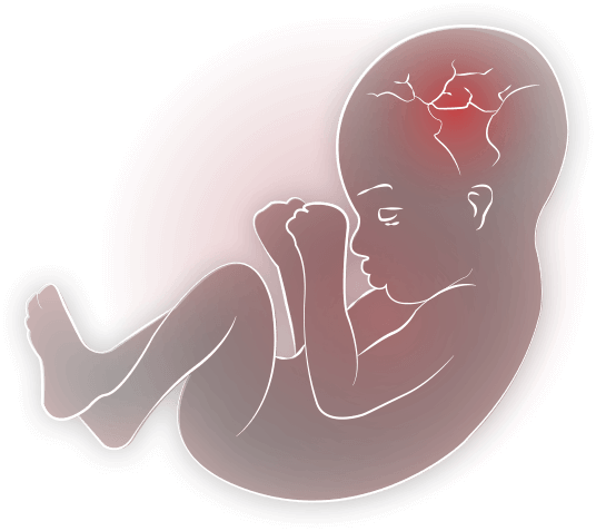 Fetal Development Illustration PNG image