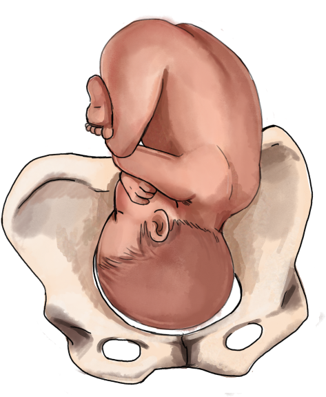 Fetal Positionin Pelvis PNG image