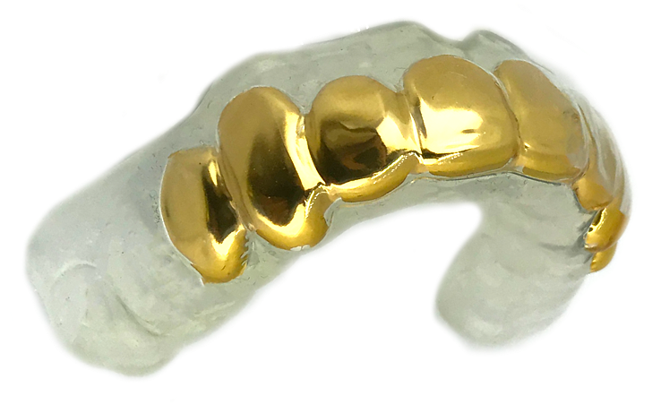 Gold Dental Crown Mold PNG image