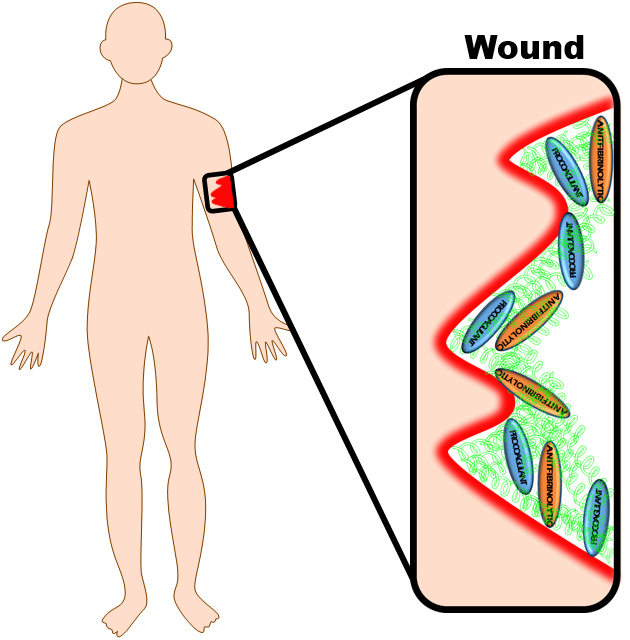 Human Anatomy Wound Diagram PNG image