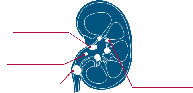 Kidney Anatomy Diagram PNG image