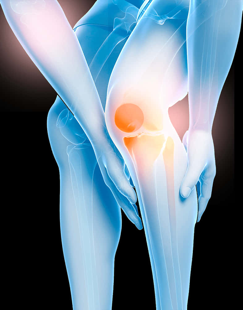 Knee Pain Illustration.jpg PNG image