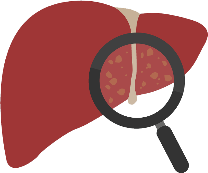 Liver Health Examination Concept PNG image