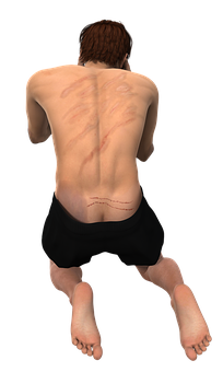 Man Kneeling Back Scars PNG image