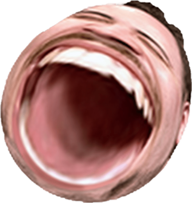 Pog Champ Emote Distorted PNG image