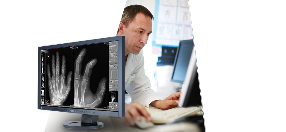 Radiologist Analyzing Hand Xray PNG image