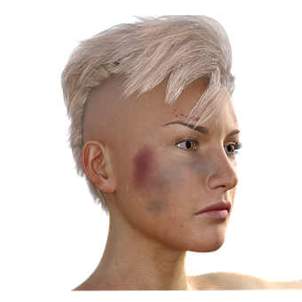 Womanwith Bruisesand Scars PNG image