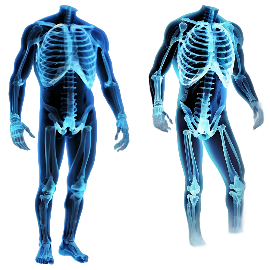 X Ray Png Images (100++)