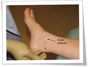 Ankle Injection Demonstration PNG image