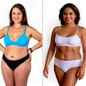 Bariatric Surgery Before And After PNG 06252024 PNG