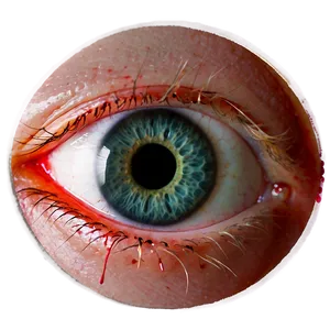 Bloodshot Eye Educational Png 8 PNG image