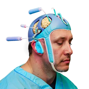 Brain Surgery Close-up PNG 06252024 PNG