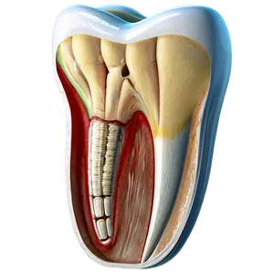 Cavity In Tooth Png Uoq PNG image