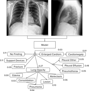 Chest Xray Diagnostic A I Analysis PNG image