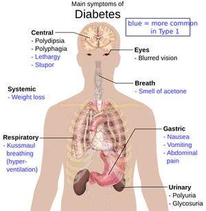 Diabetic Ketoacidosis Symptoms Infographic PNG image