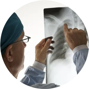 Doctor Examining Chest Xray PNG image