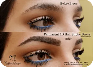 Eyebrow Enhancement Before After PNG image